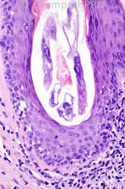picture-1