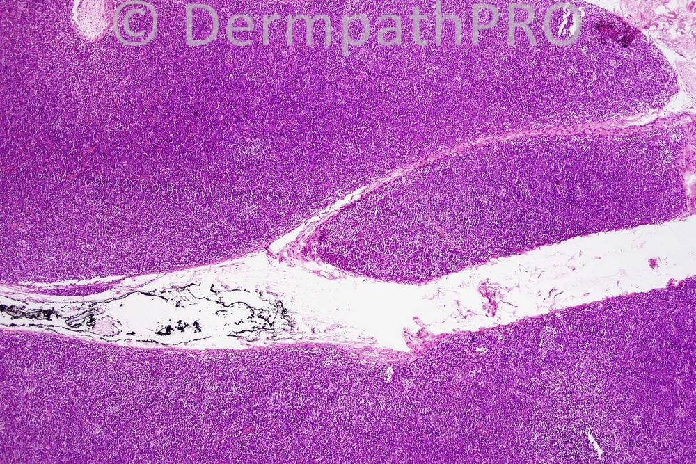 picture-1