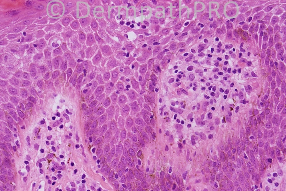 picture-3