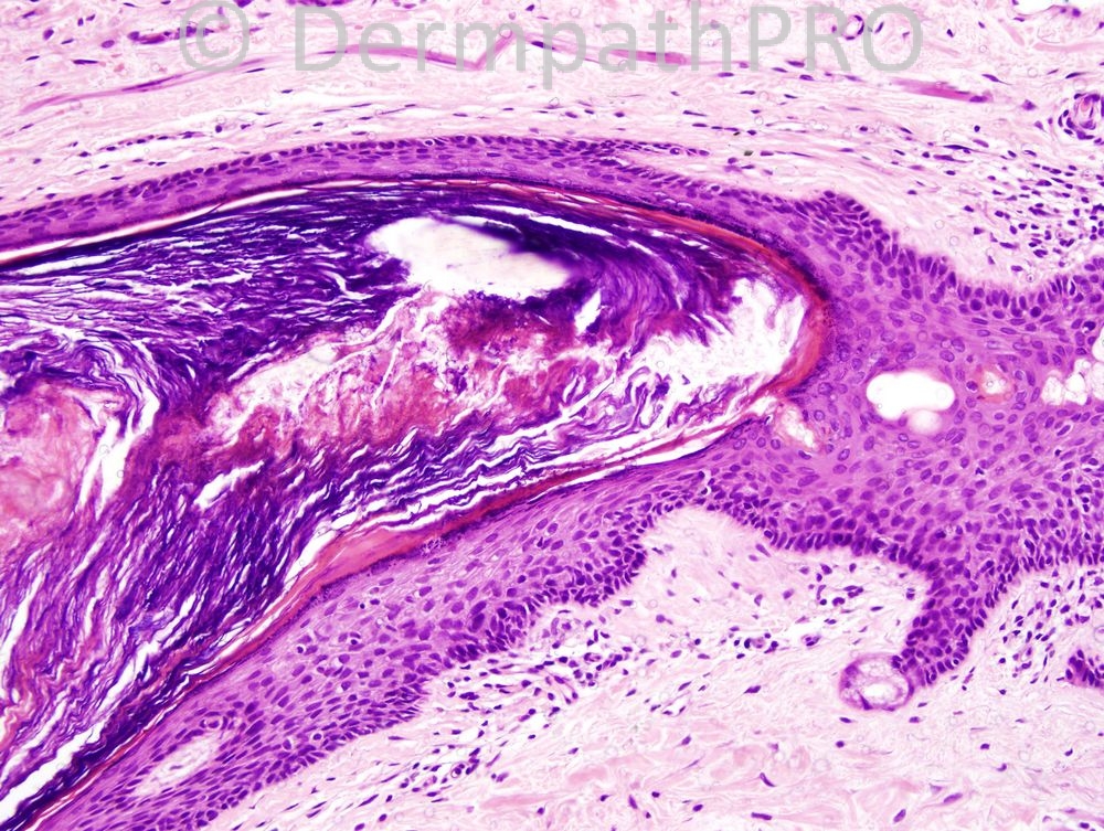 picture-2
