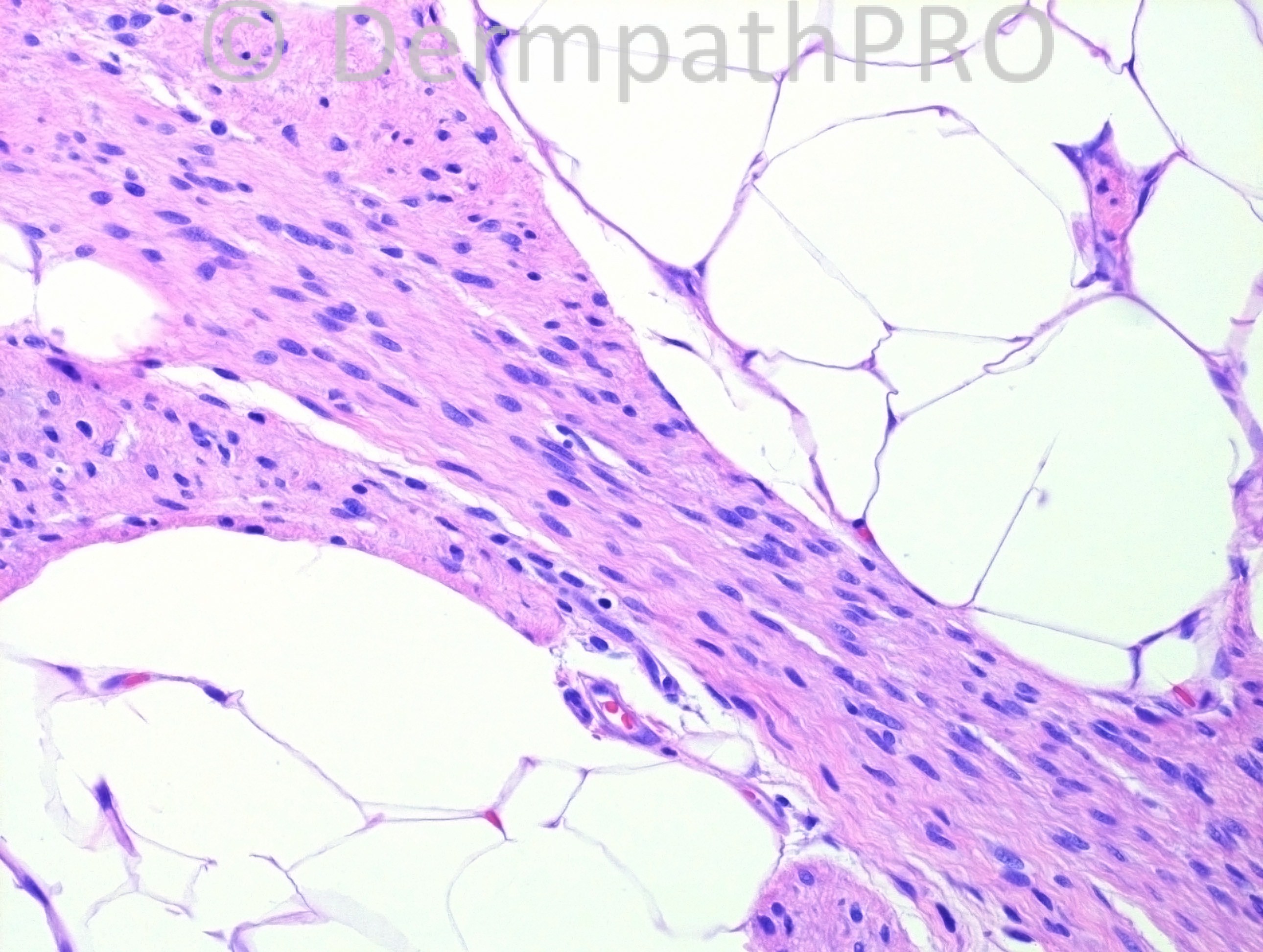 picture-5
