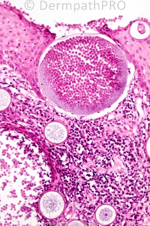 picture-1