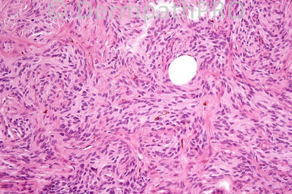 picture-3