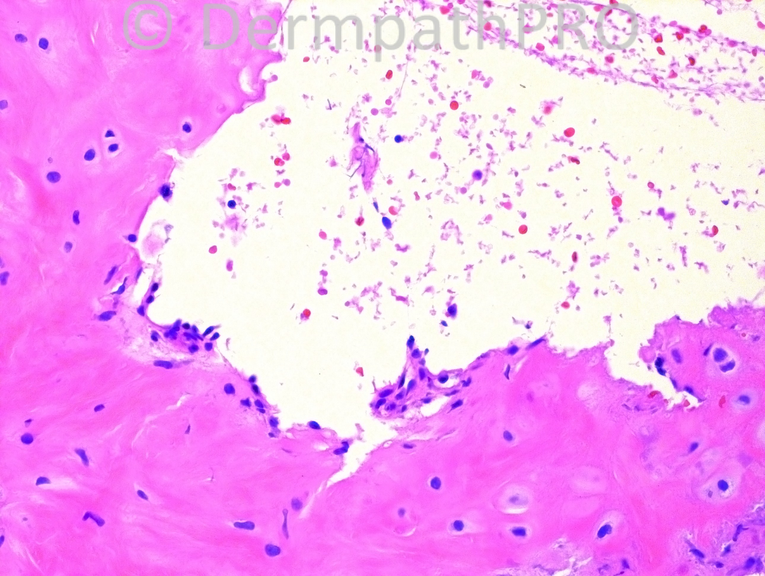 picture-4