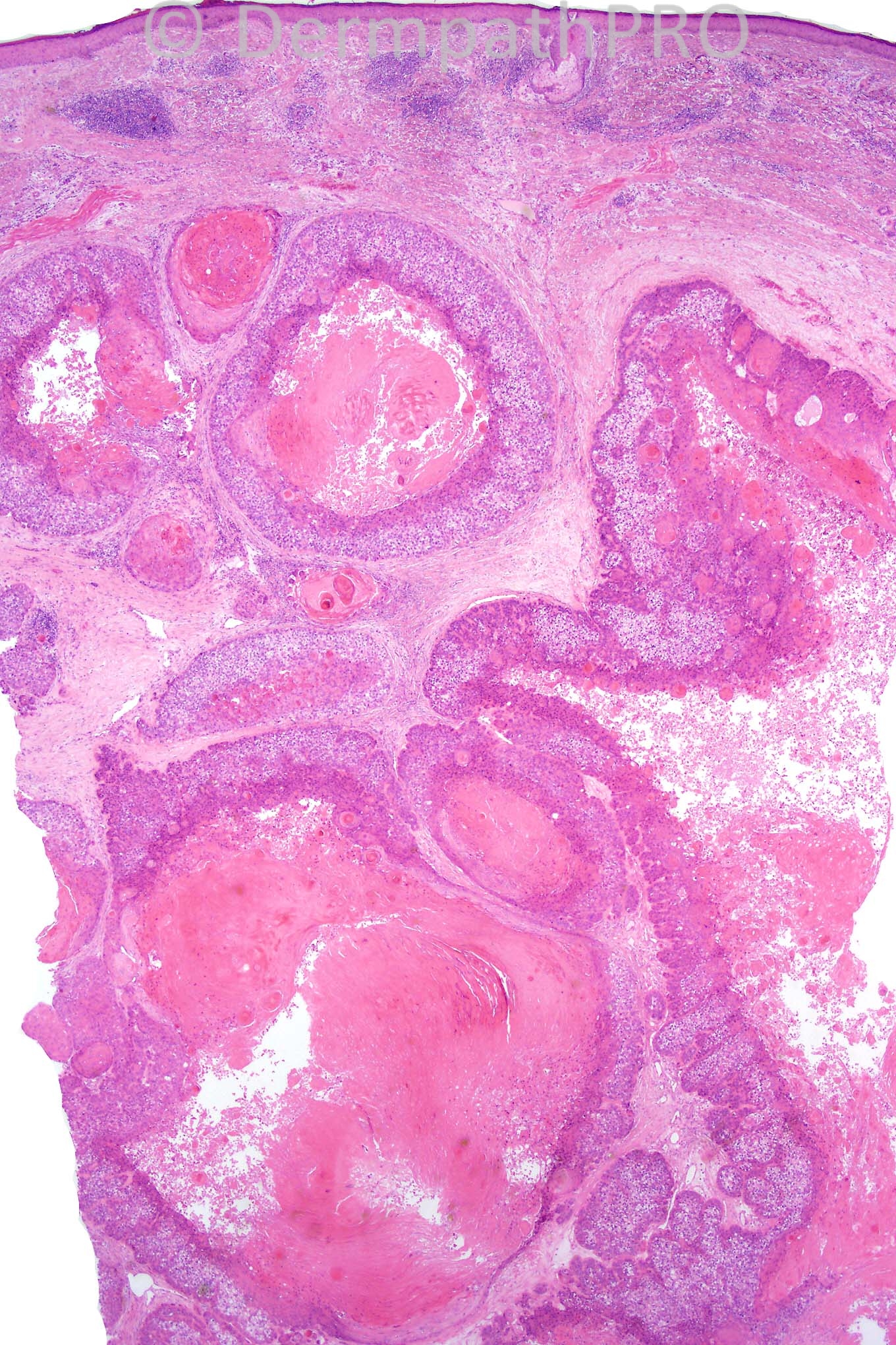 picture-1
