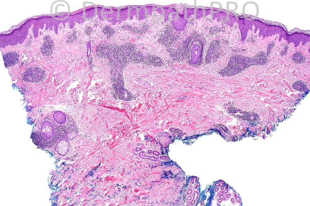 picture-1