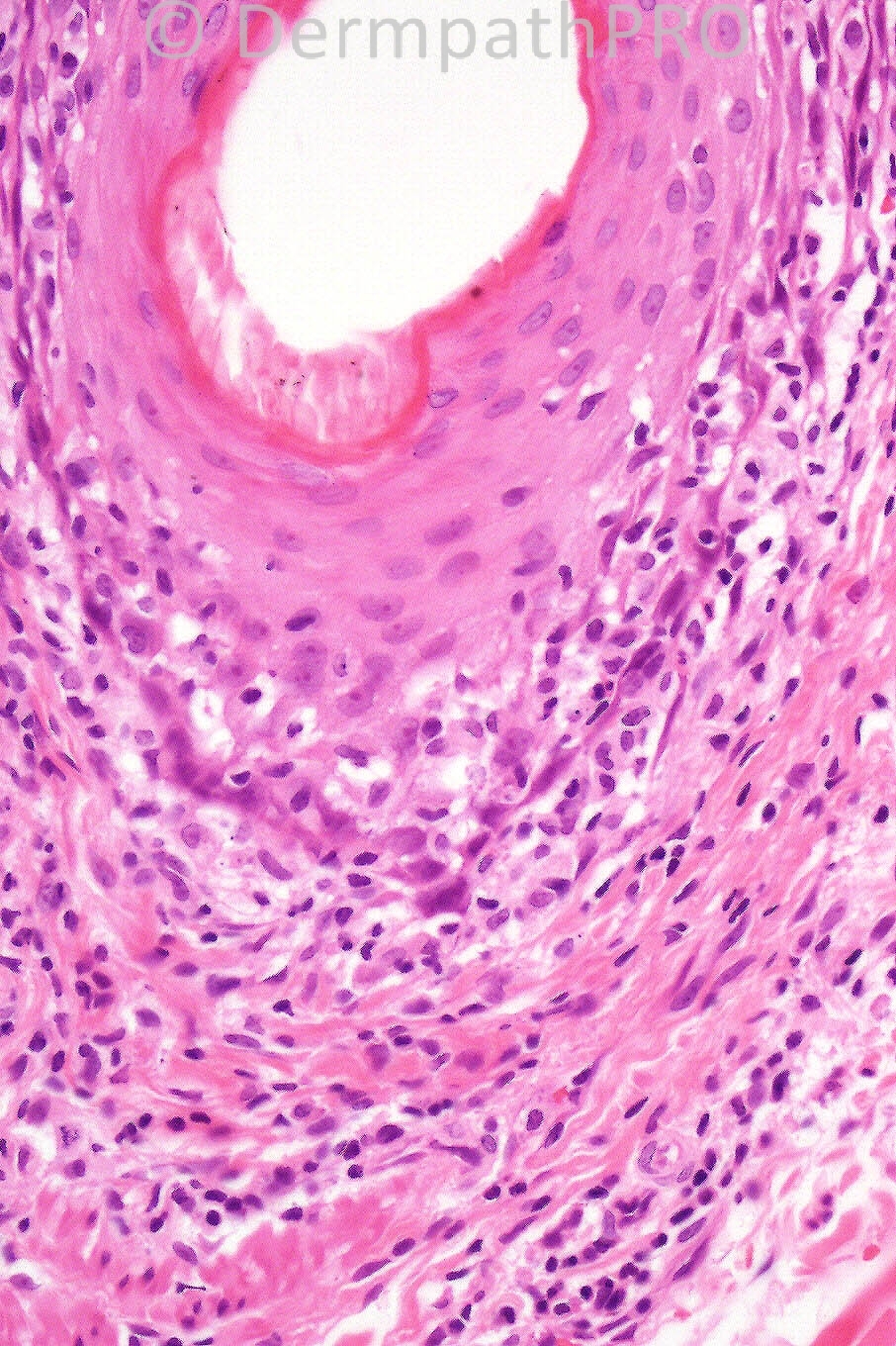 picture-3