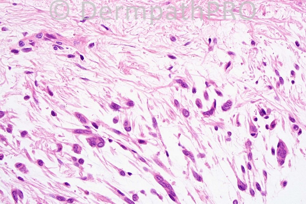 picture-4