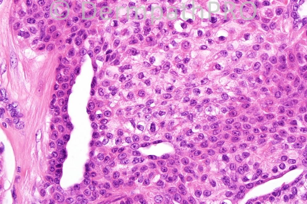 picture-3