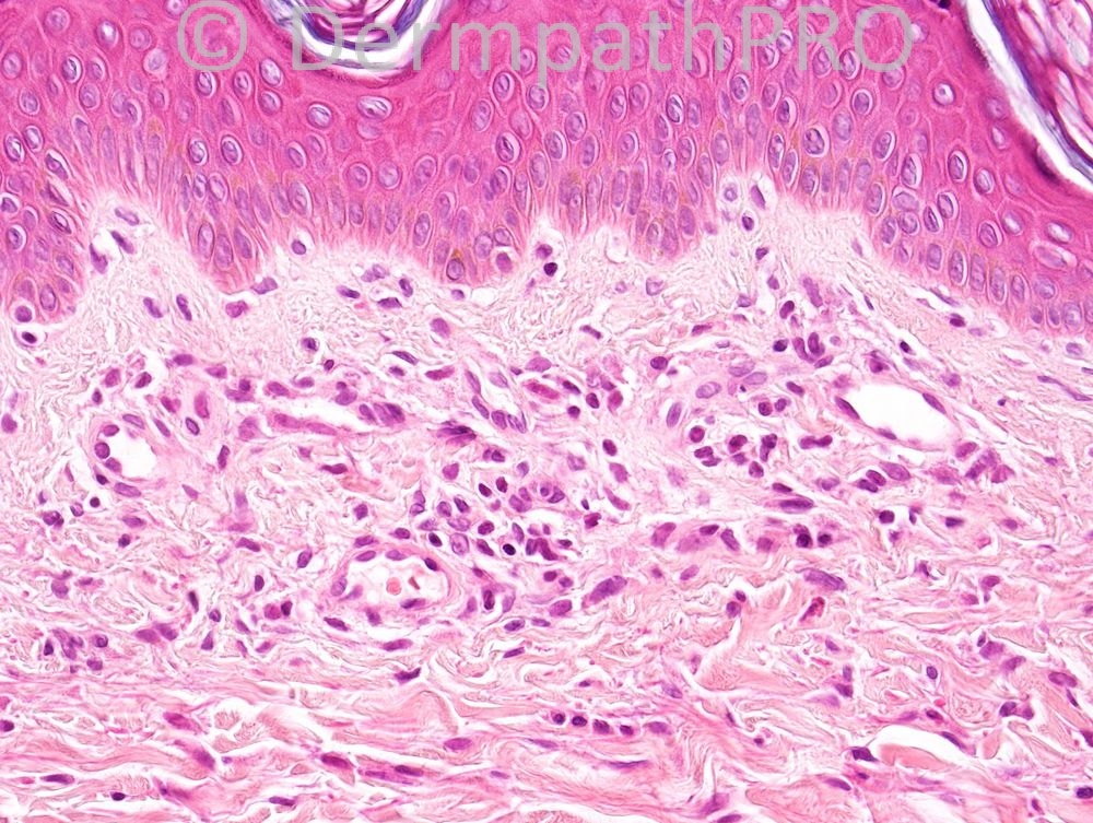 picture-1