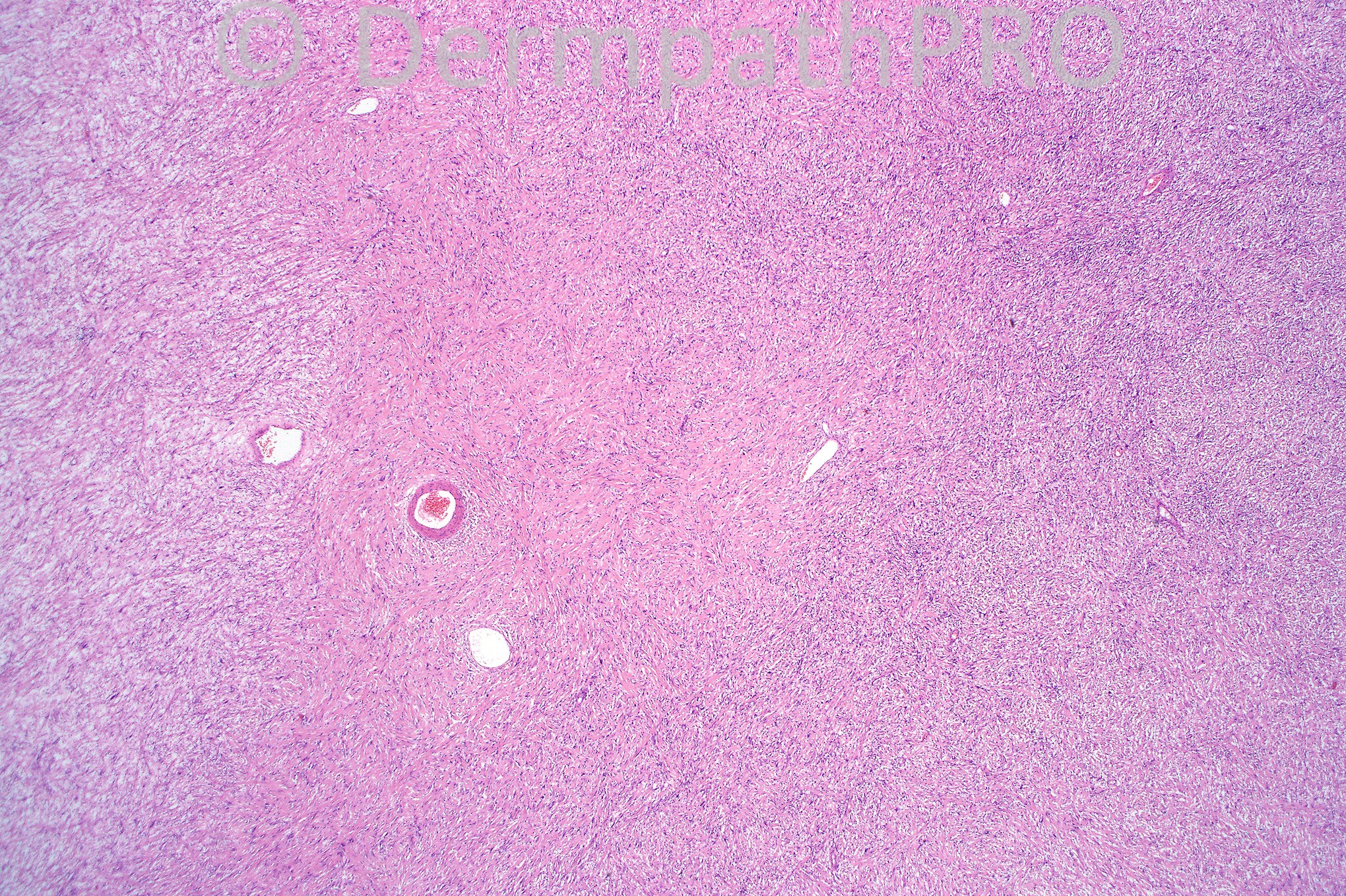 picture-1