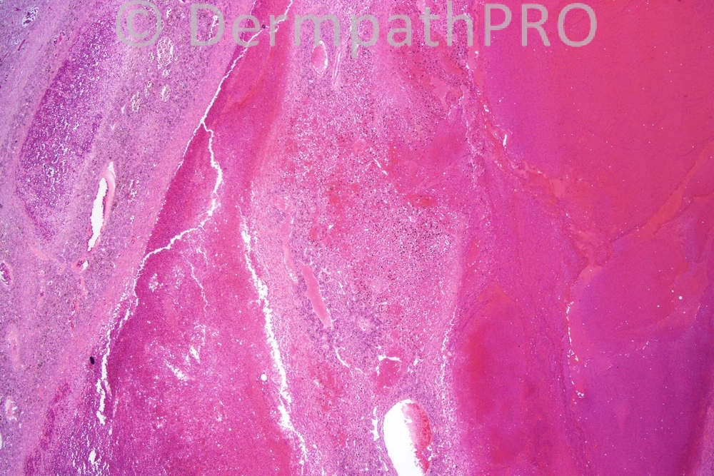 picture-1