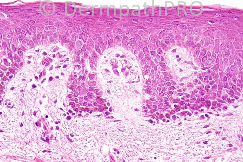picture-4