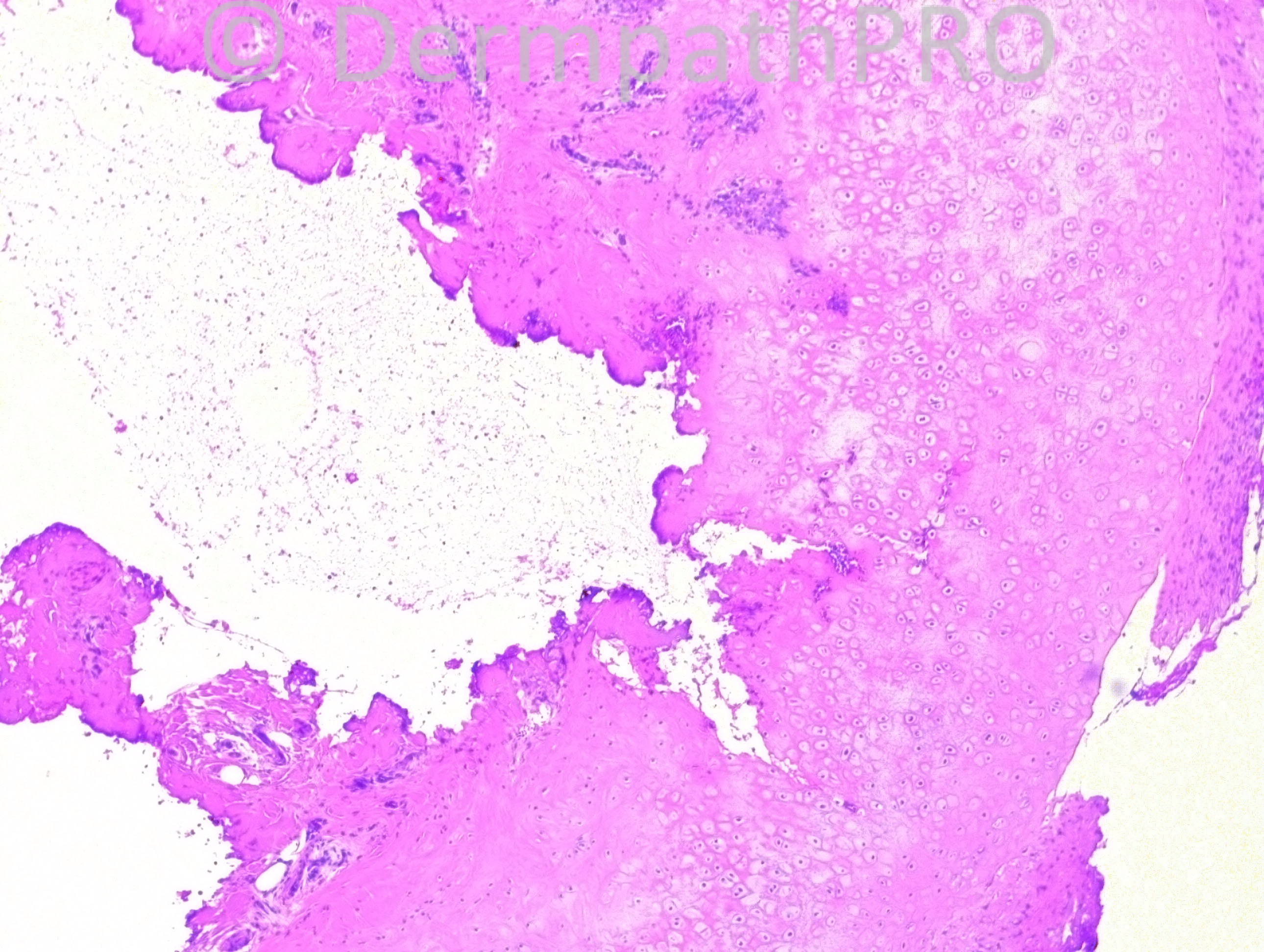 picture-2
