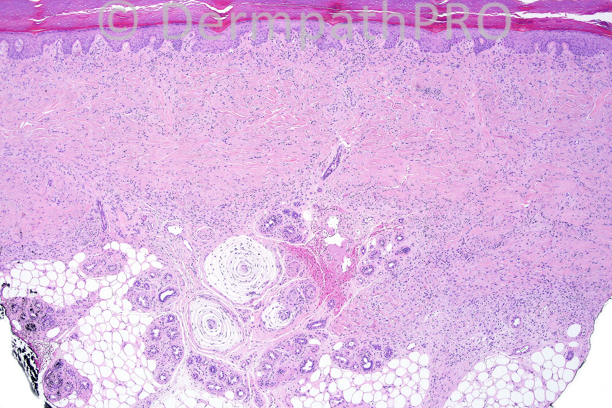 picture-1