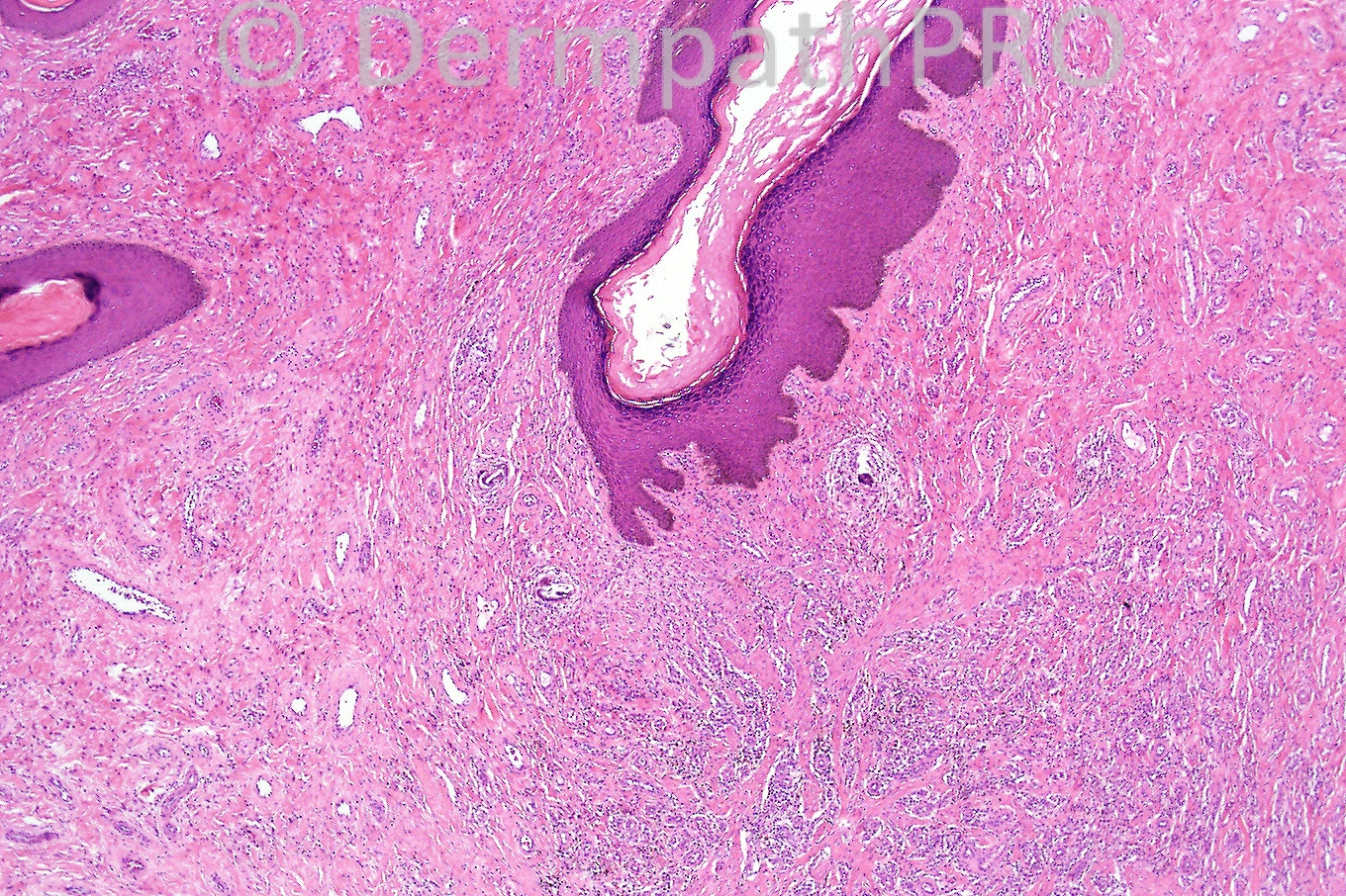 picture-1