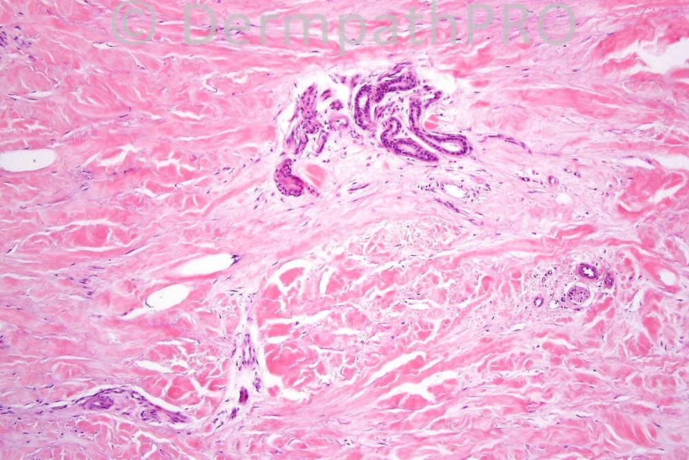 picture-3