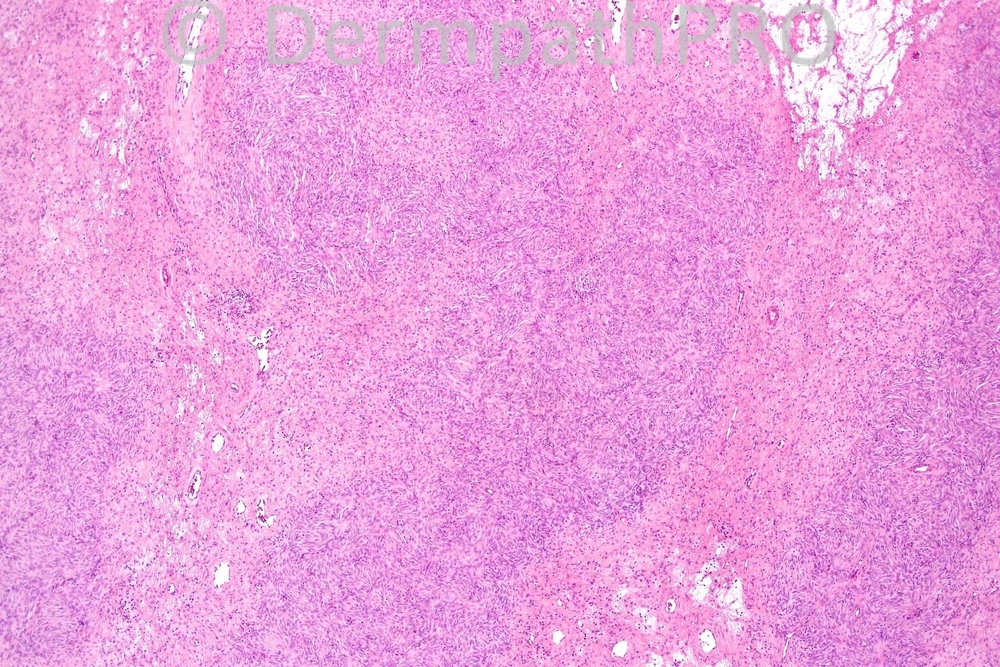 picture-1