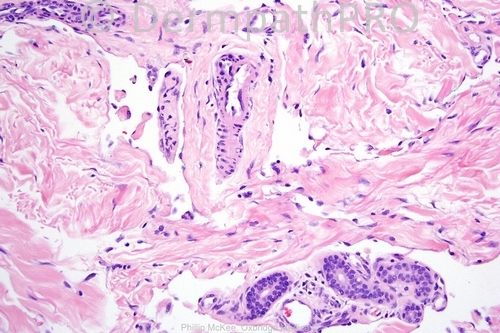 picture-1