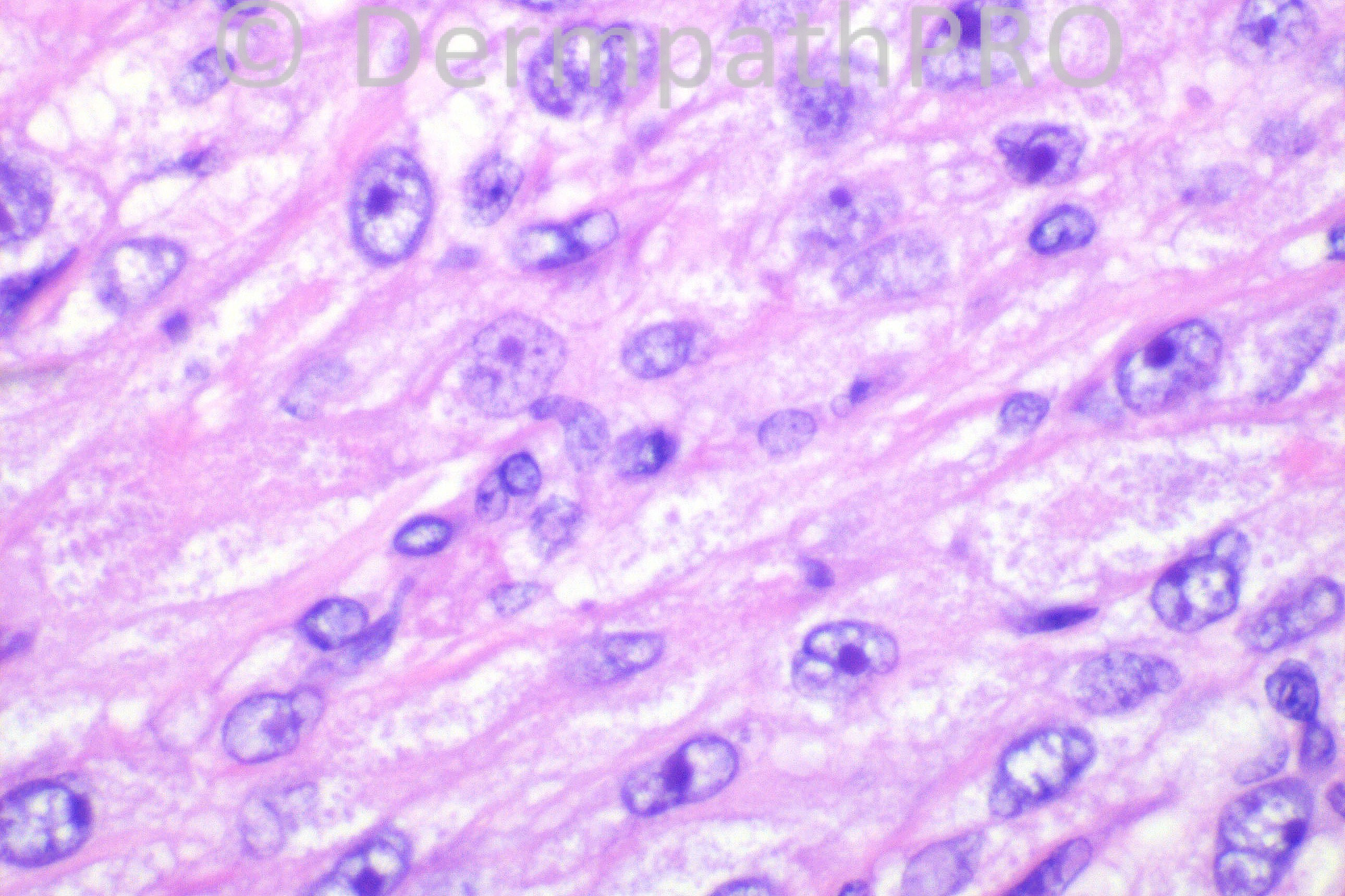 picture-3