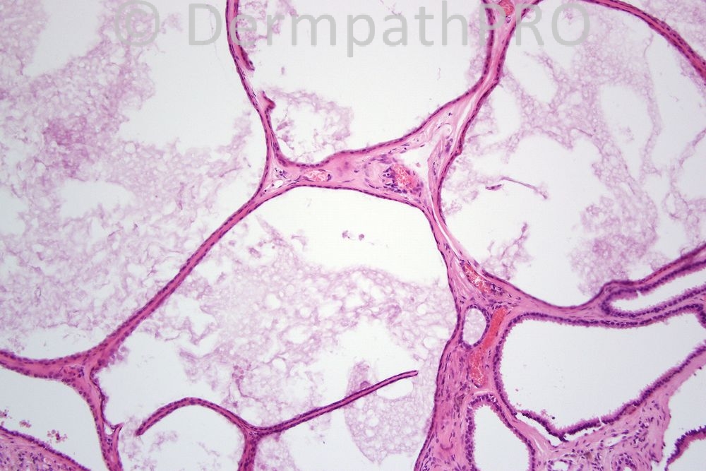 picture-2