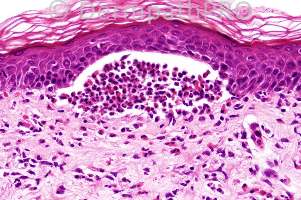 picture-4