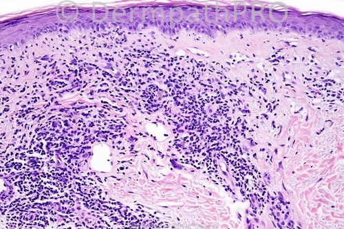 picture-1