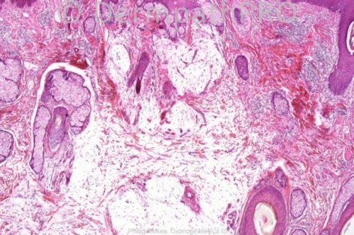 picture-1