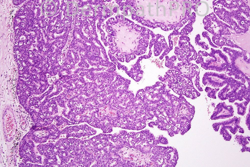 picture-1