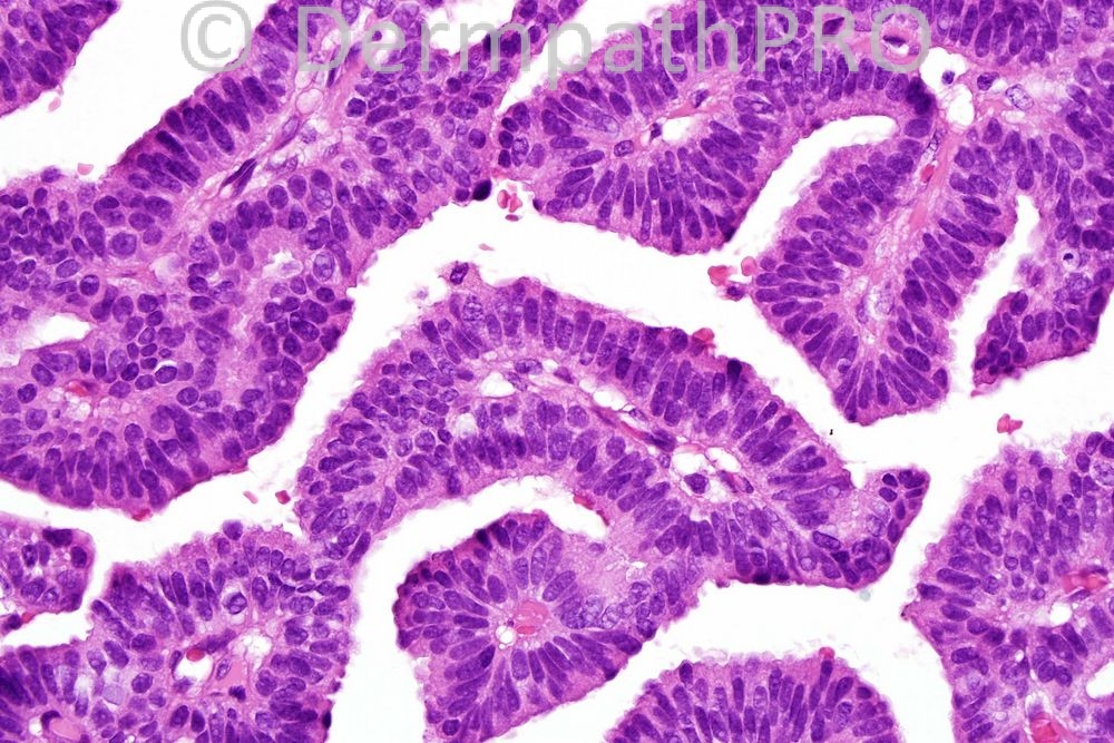 picture-4