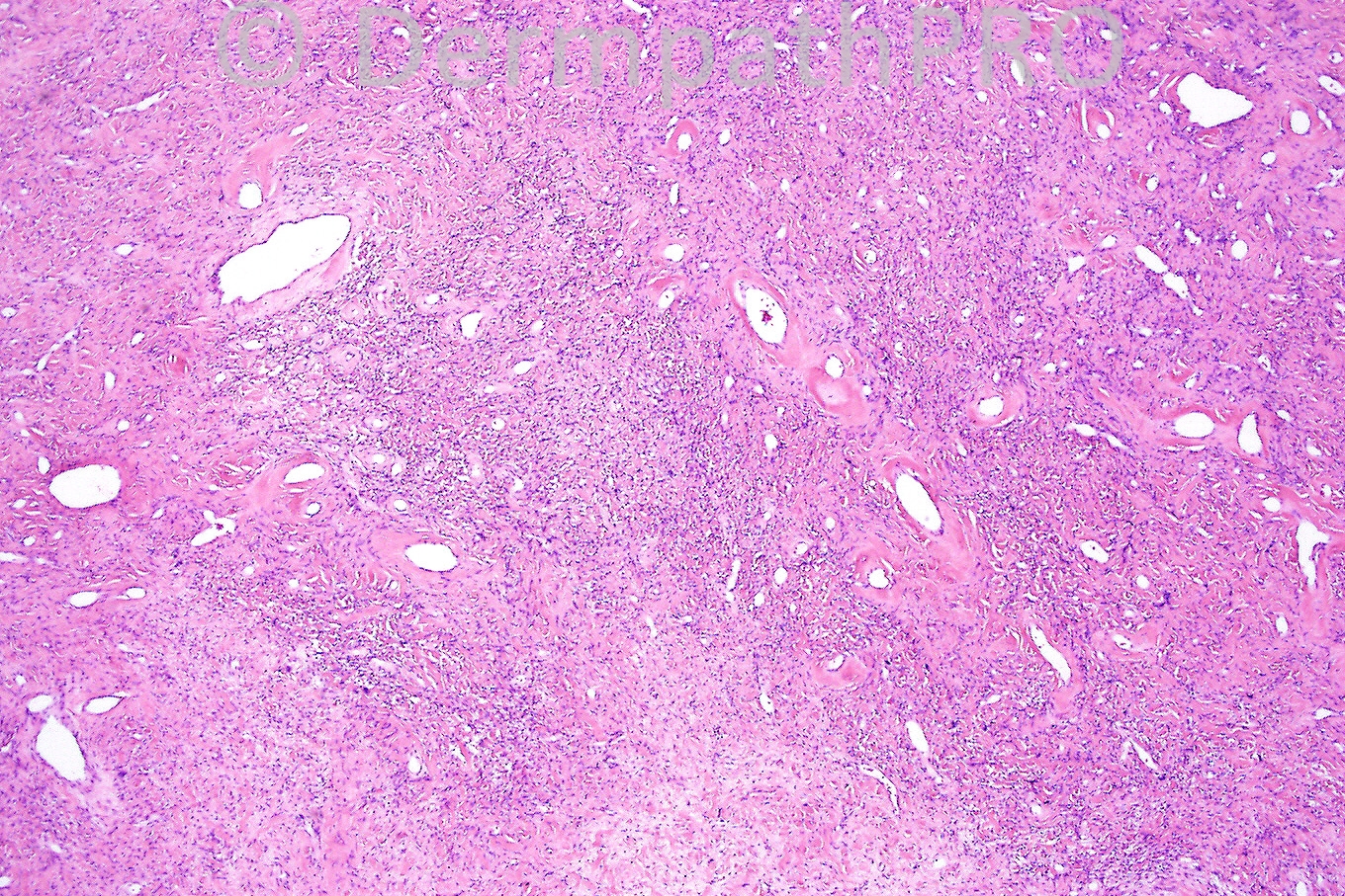 picture-1