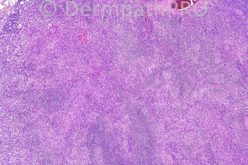 picture-1
