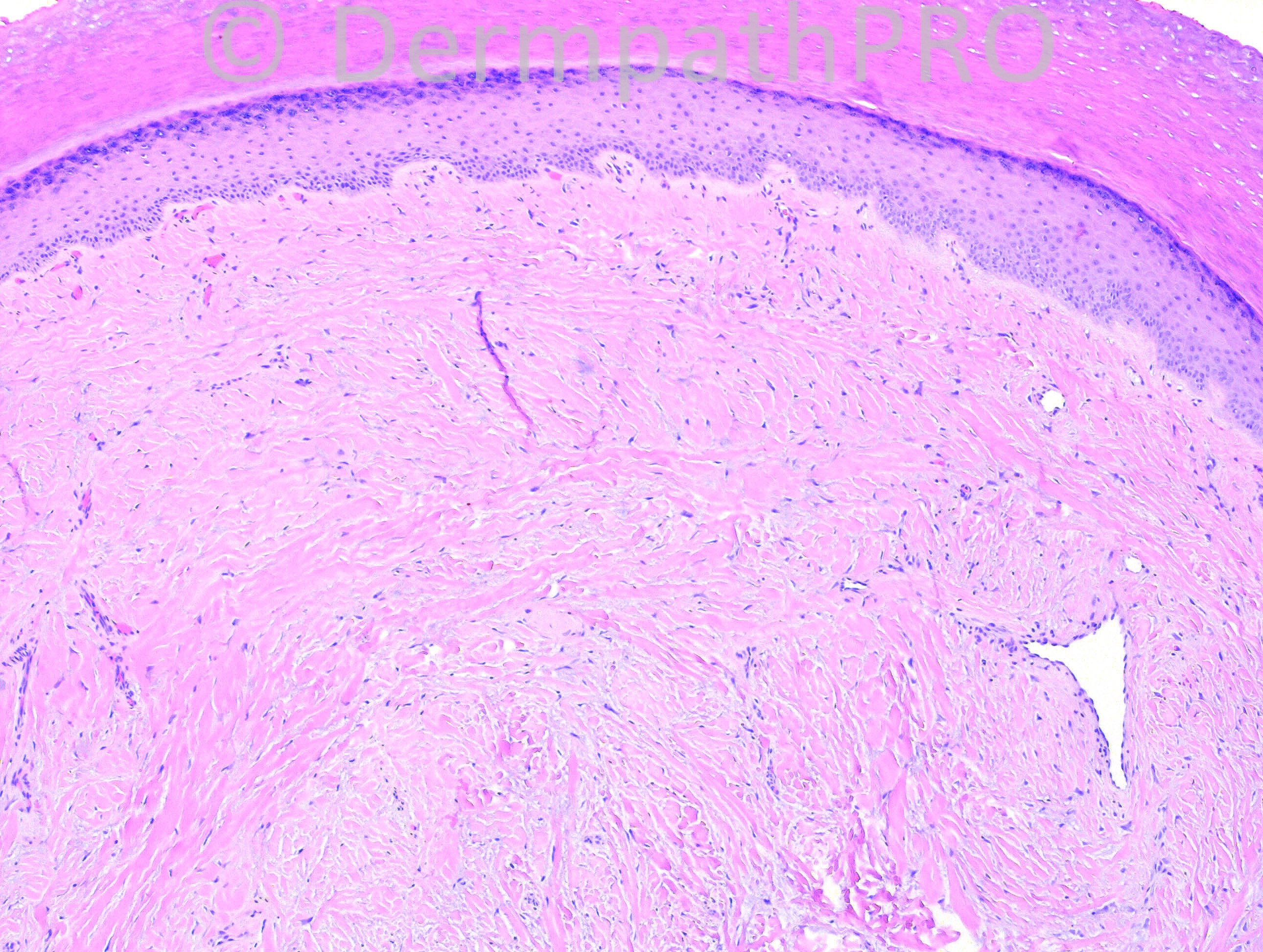 picture-1