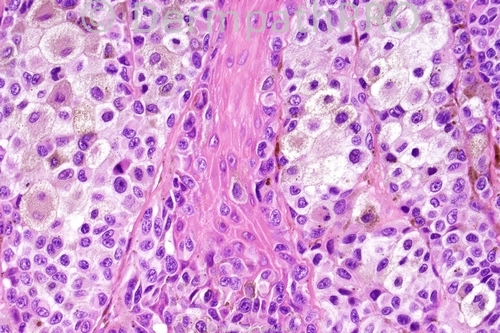 picture-1