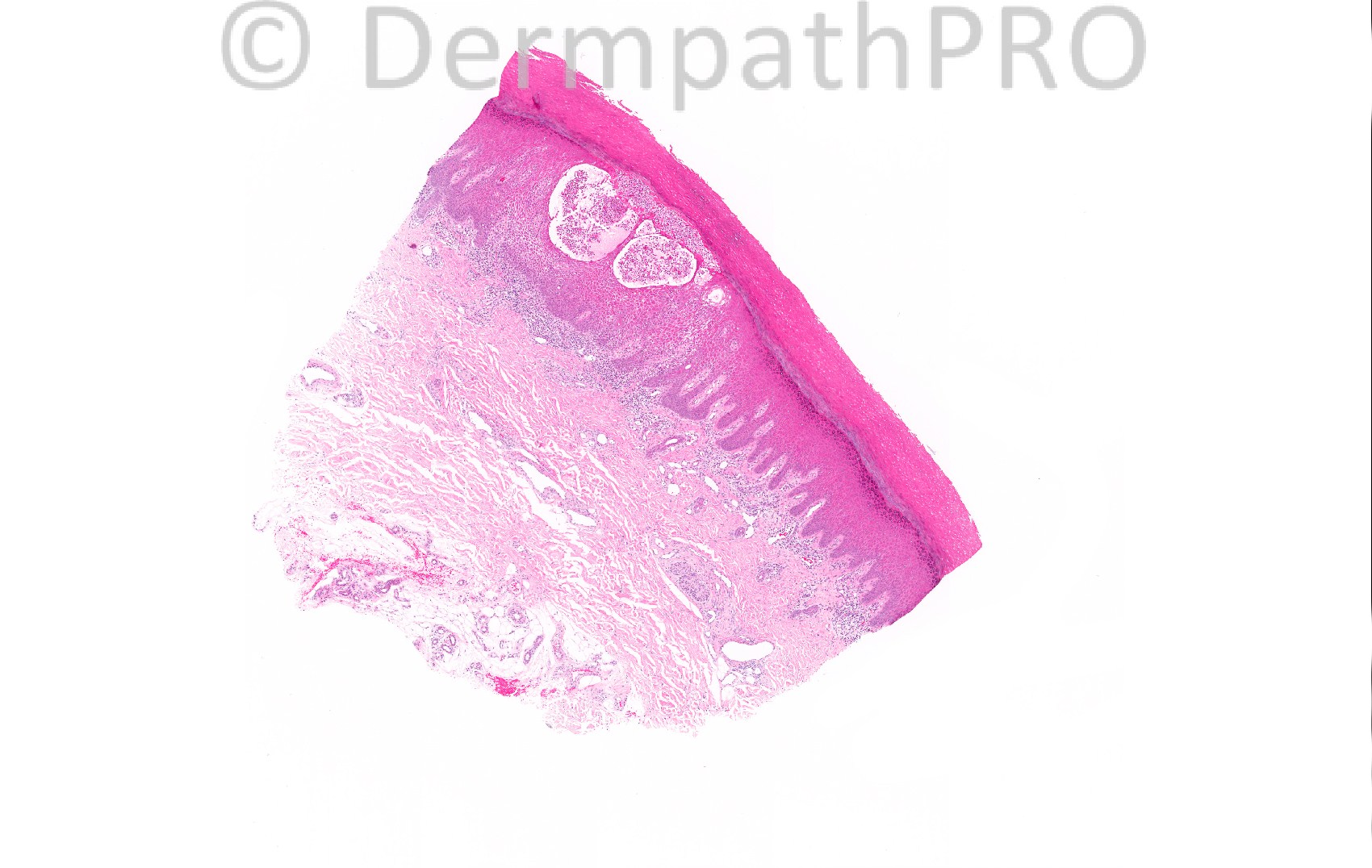 picture-1