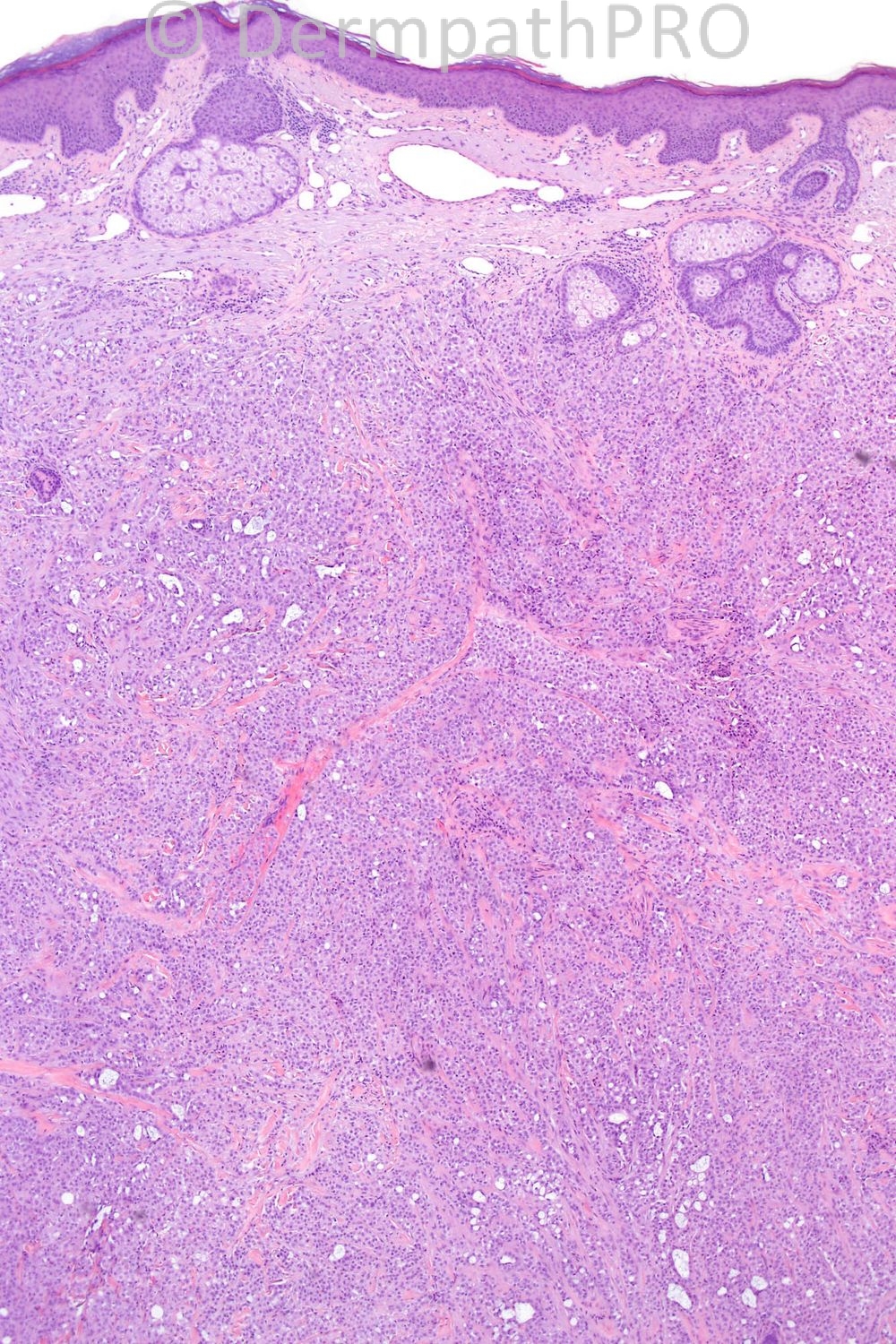 picture-1