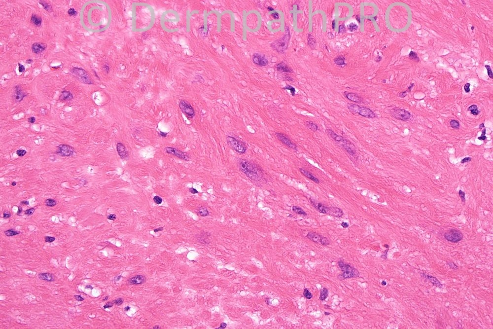 picture-4
