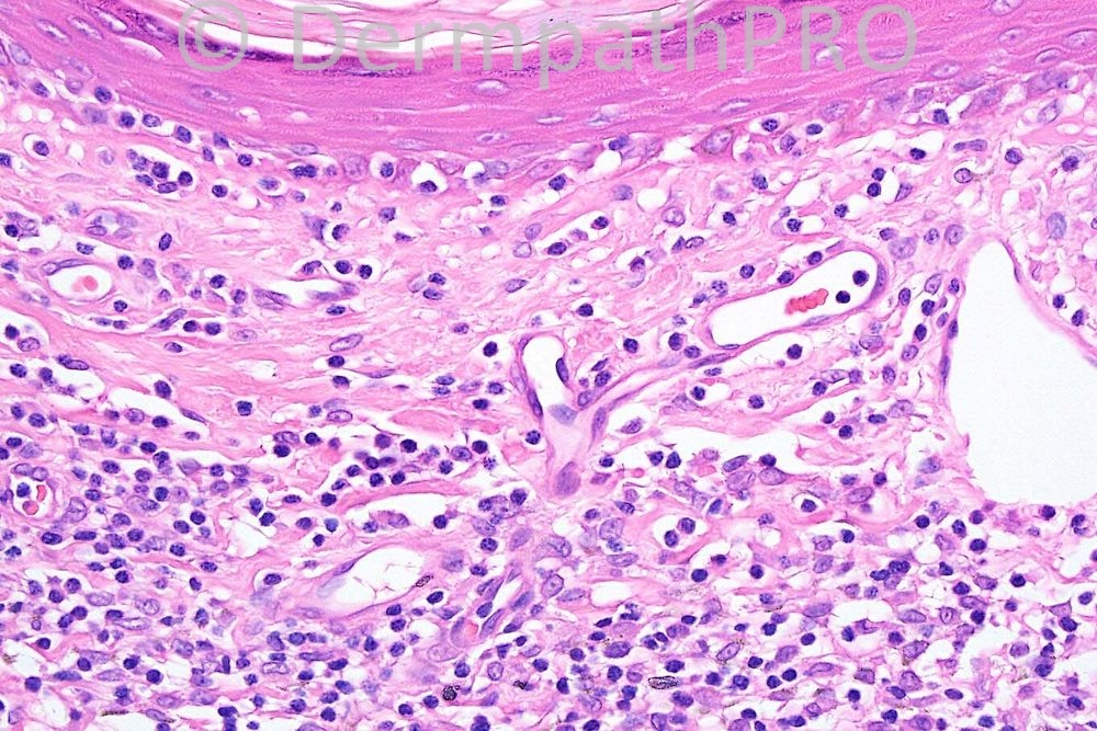 picture-4