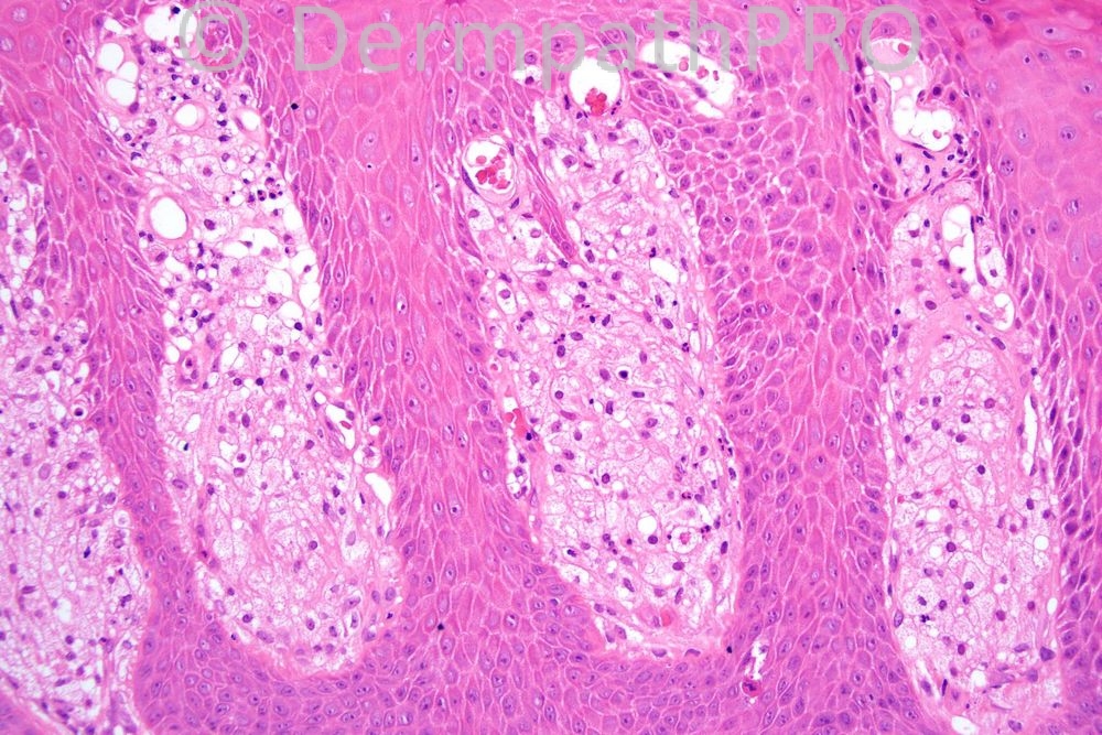 picture-3