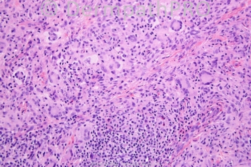 picture-1