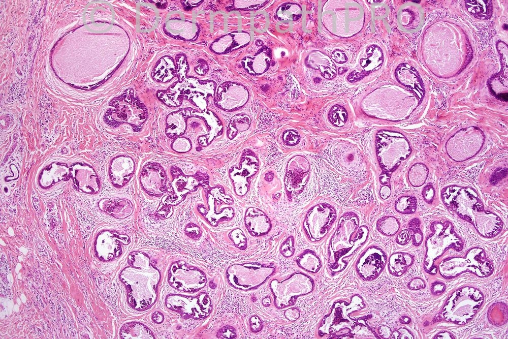 picture-1