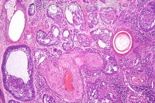 picture-1