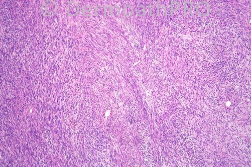 picture-1