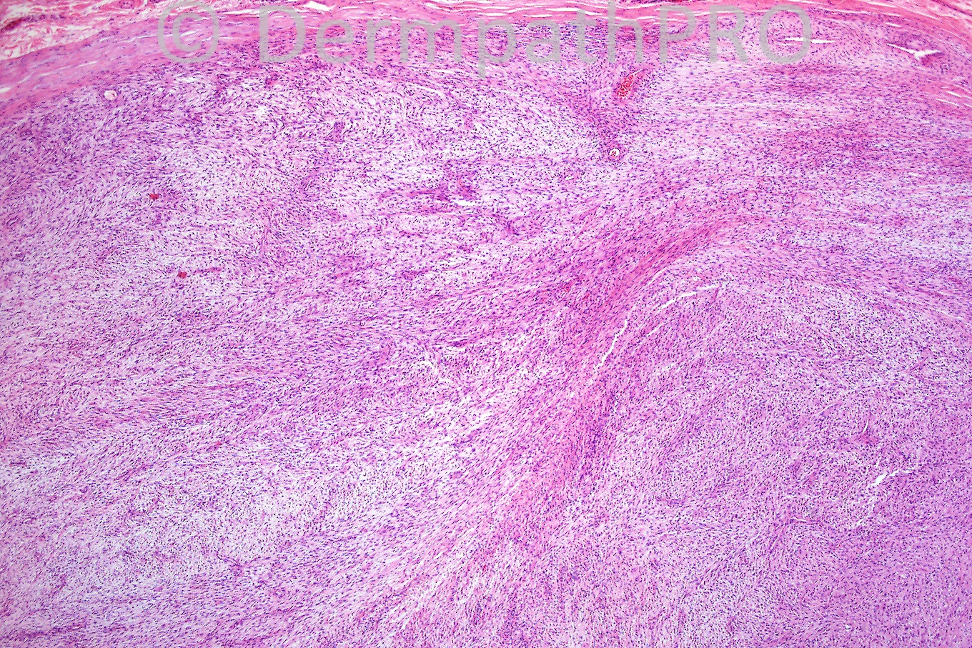 picture-1