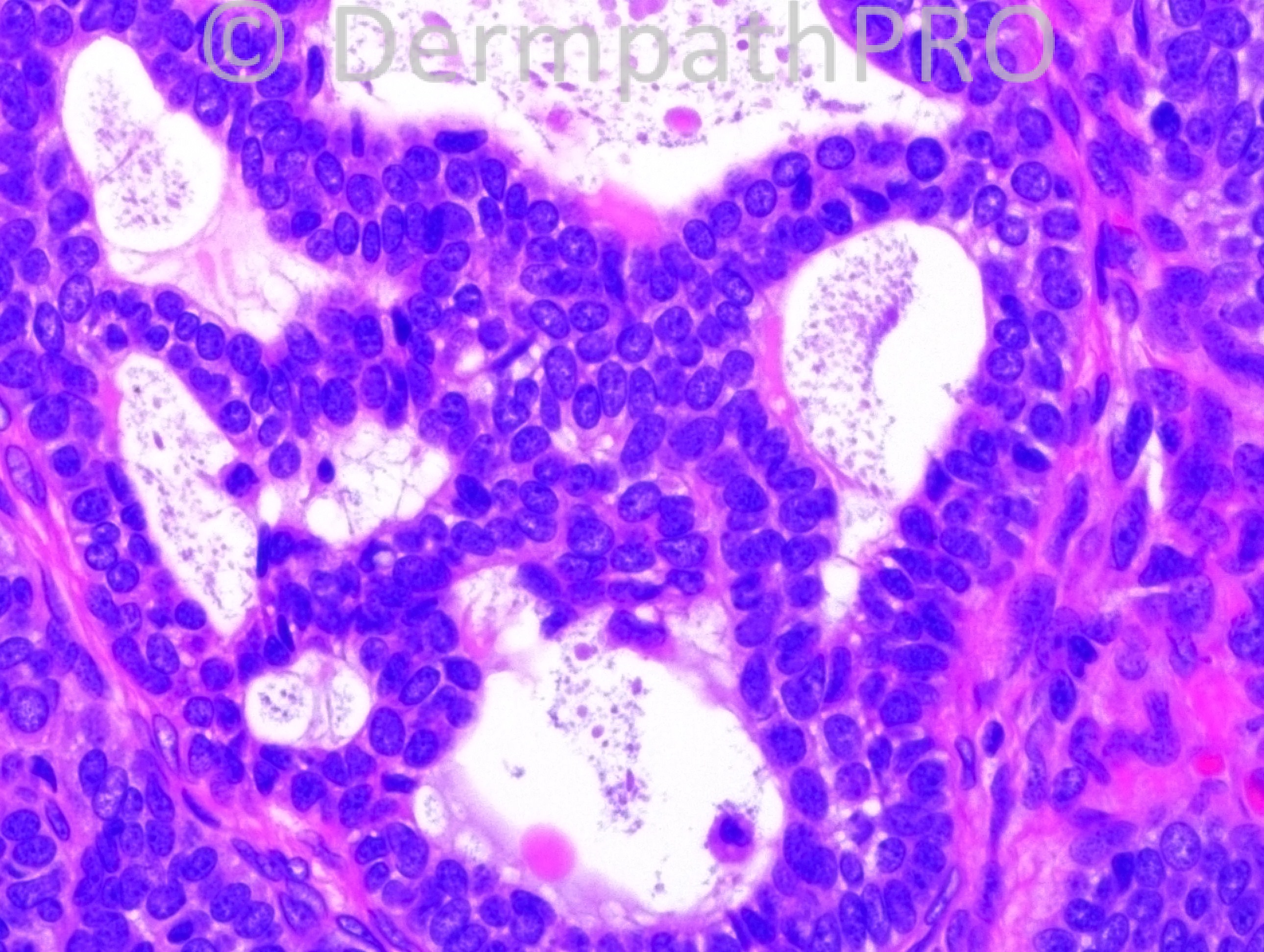 picture-4