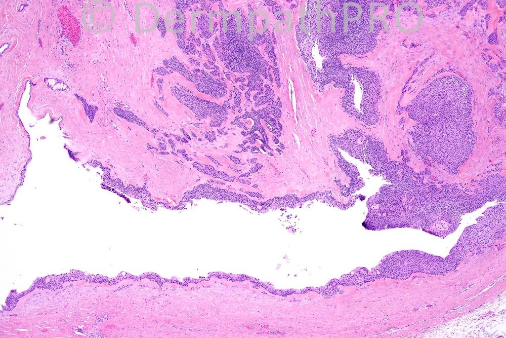 picture-1