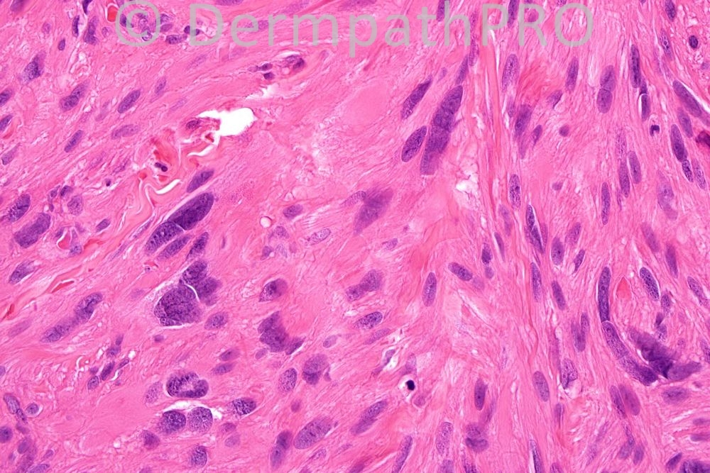 picture-3
