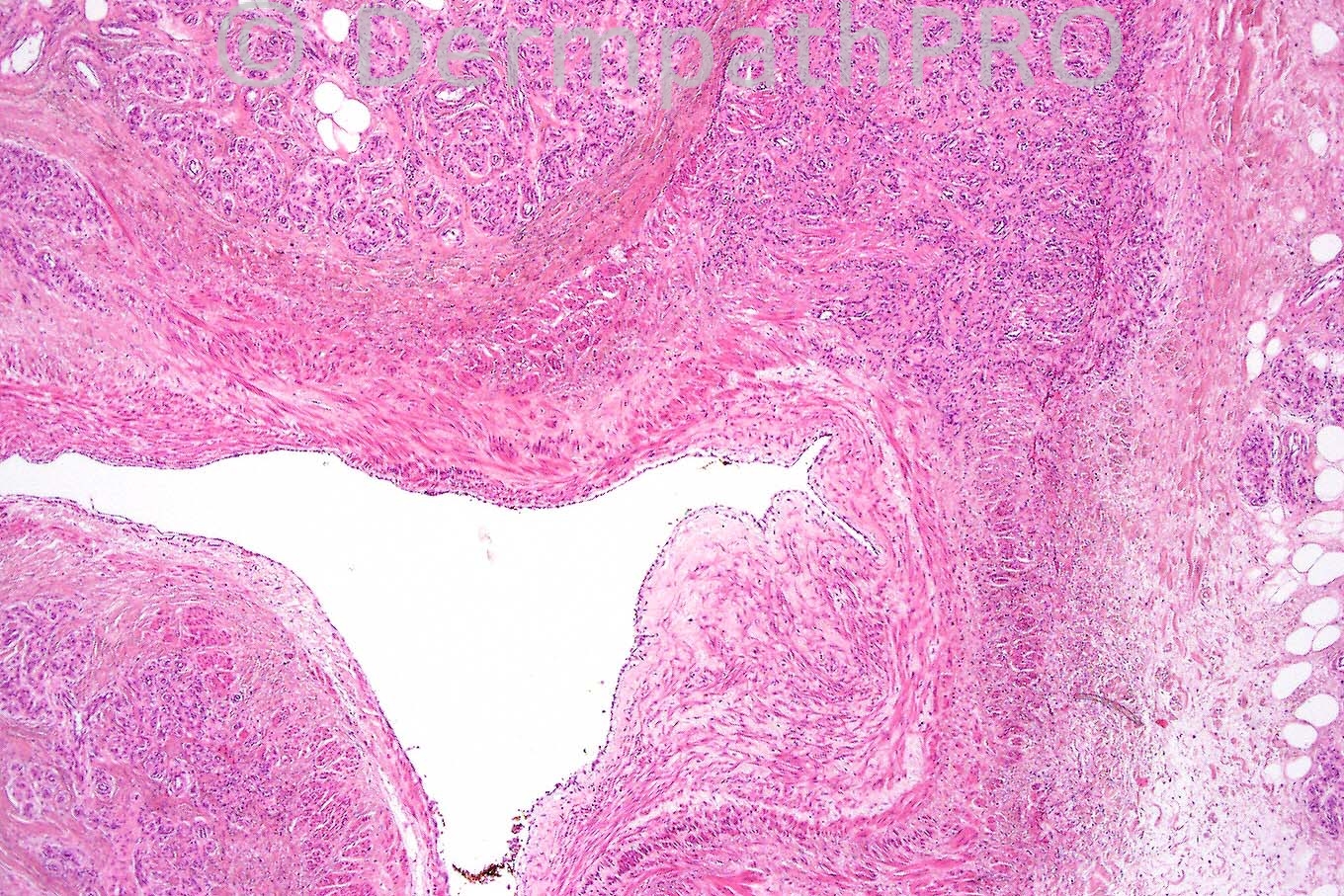picture-2