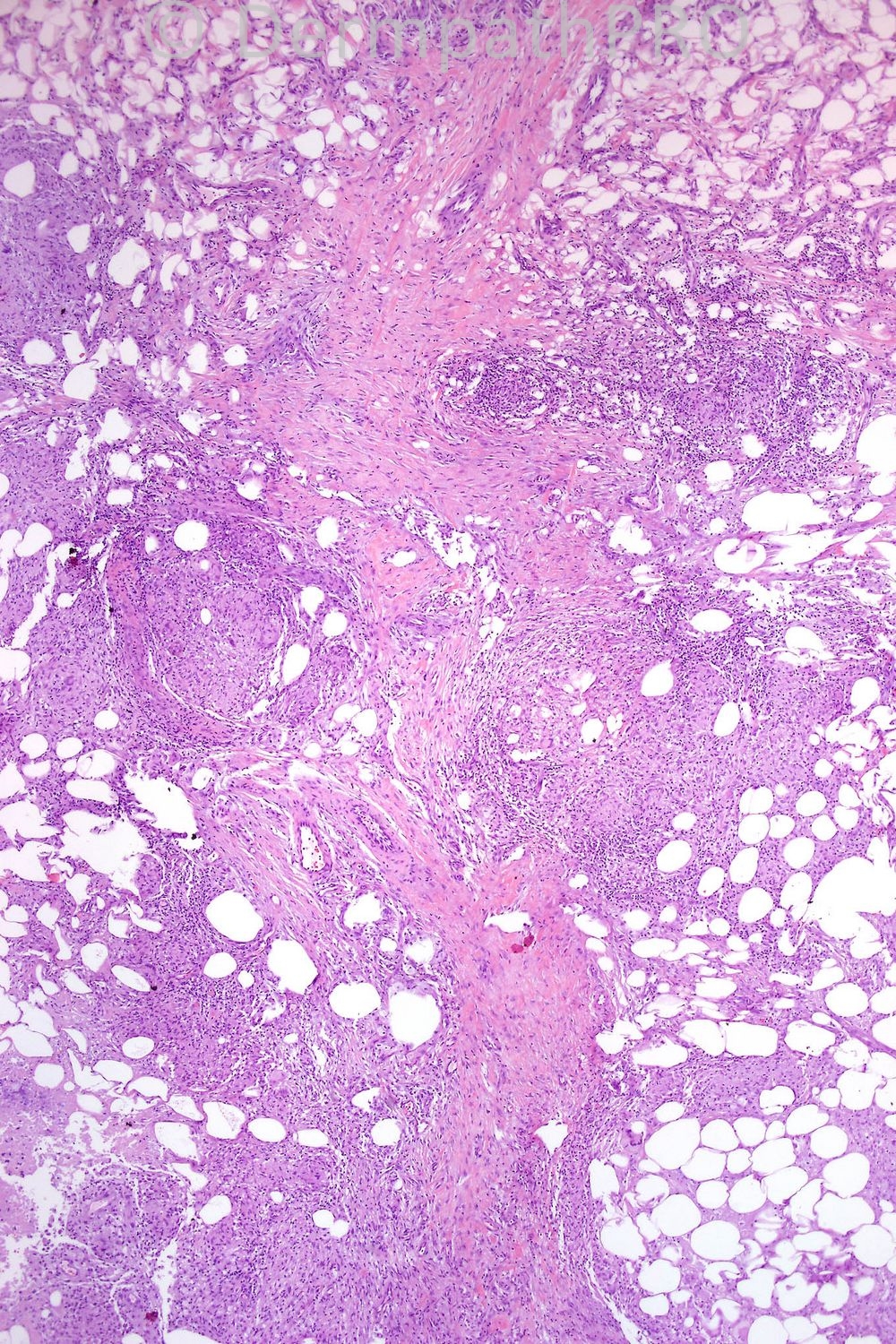 picture-1