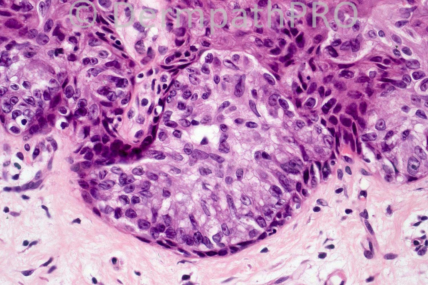 picture-6